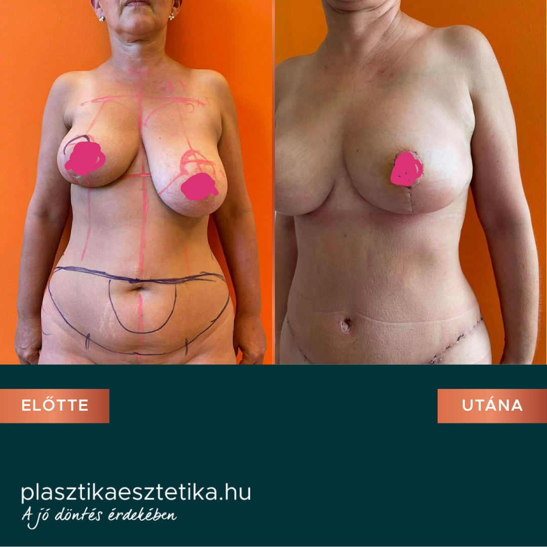 Dr. Sebesty n Judith Plasztika Eszt tika