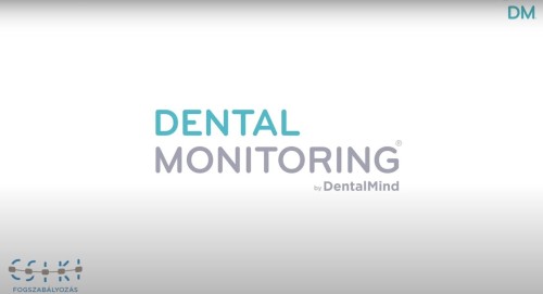 Mi is az a Dental Monitoring? Dr. Csiki Péter elárulja!