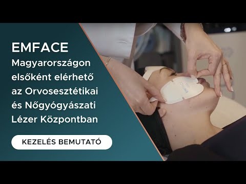 EMFACE - Magyarországon elsőként elérhető