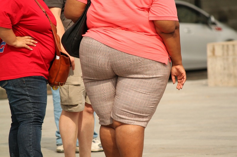 A kóros elhízás nem akaratgyengeség! - Izzasztó órák az edzőteremben, embert próbáló diéták kontra mozdulatlan kilók